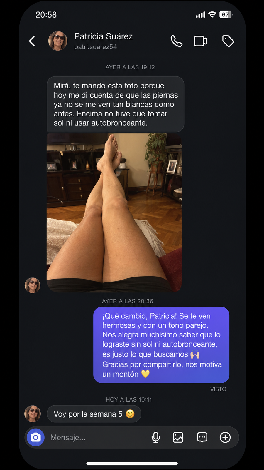 Testimonio de clienta Bronzea