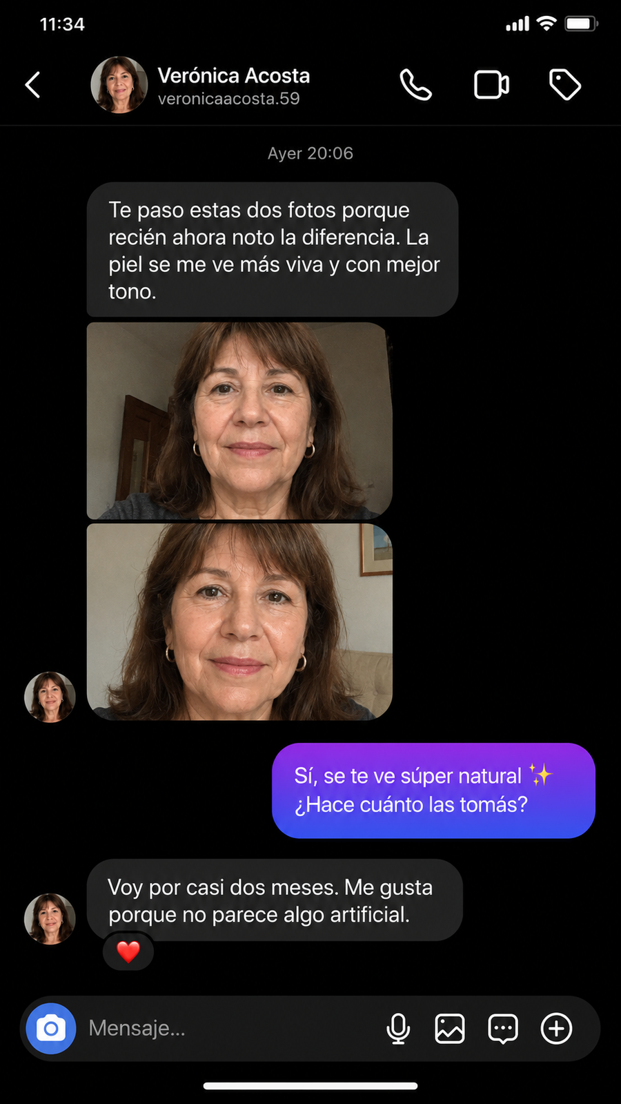 Testimonio de clienta Bronzea